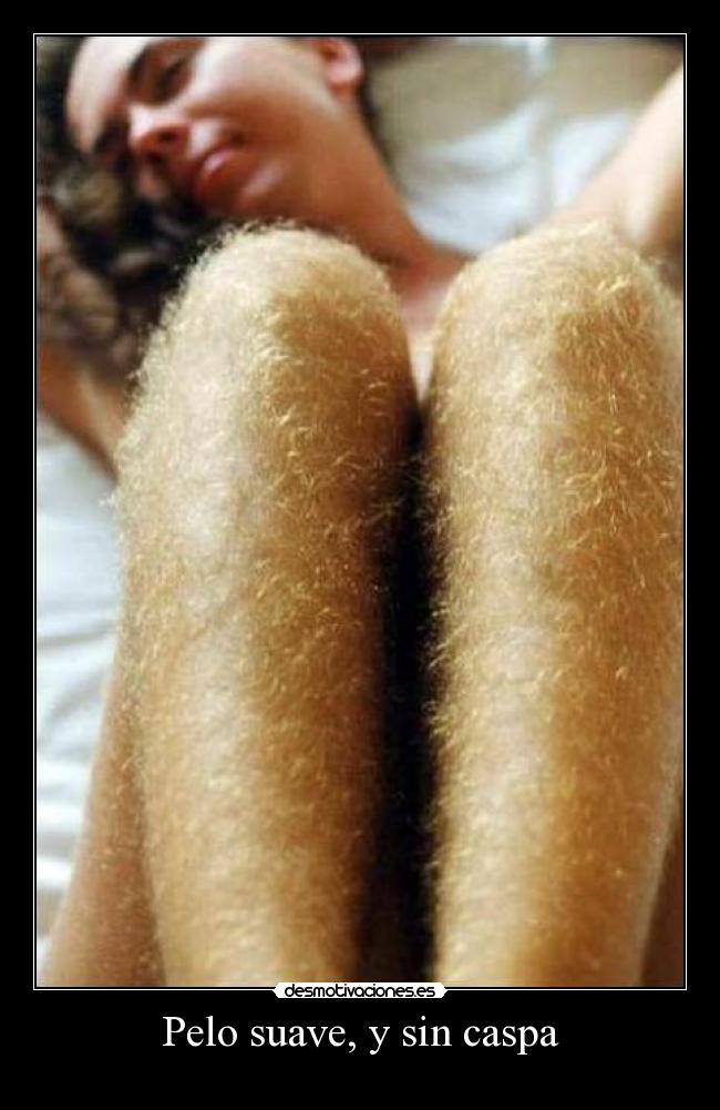 Pelo suave, y sin caspa -