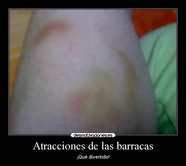 Atracciones de las barracas - ¡Qué divertido!