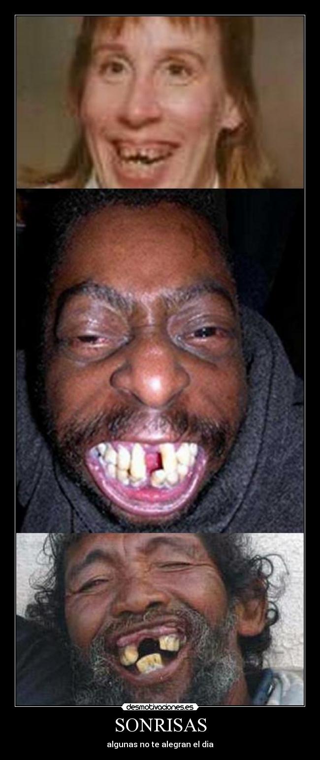 SONRISAS - algunas no te alegran el dia