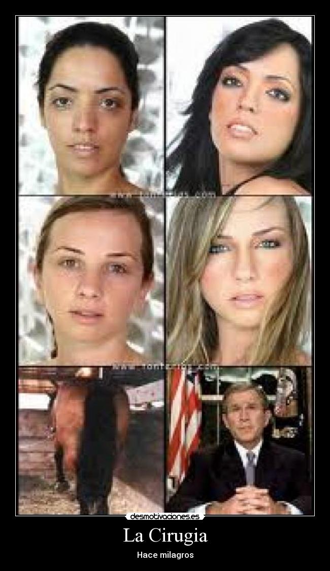 La Cirugia - Hace milagros