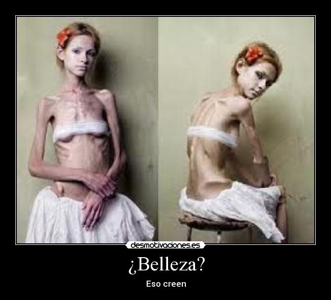 ¿Belleza? - 