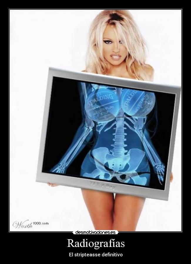 Radiografías -