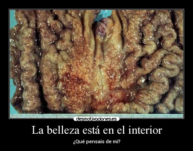 La belleza está en el interior - 