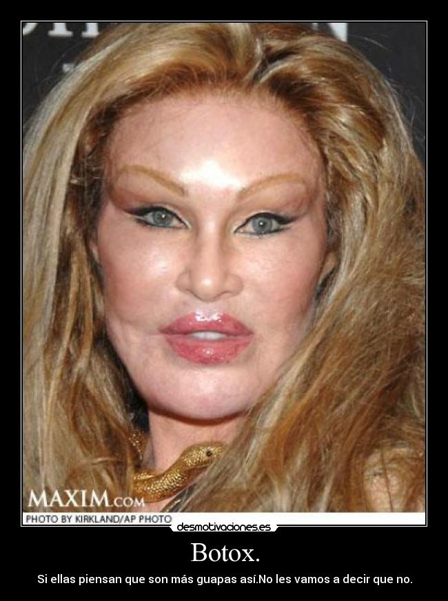 Botox. - Si ellas piensan que son más guapas así.No les vamos a decir que no.