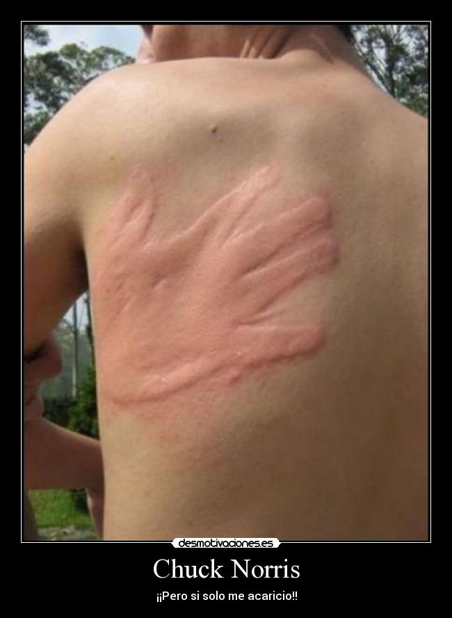 Chuck Norris - ¡¡Pero si solo me acaricio!!