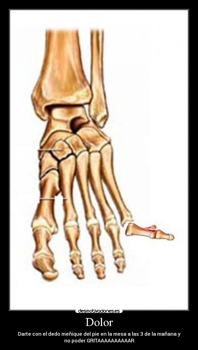 carteles dolor siempre pasa desmotivaciones