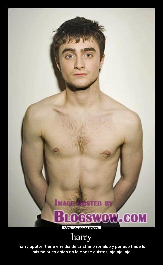 harry - 