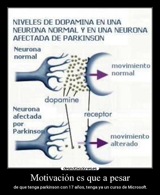 Motivación es que a pesar - de que tenga parkinson con 17 años, tenga ya un curso de Microsoft.