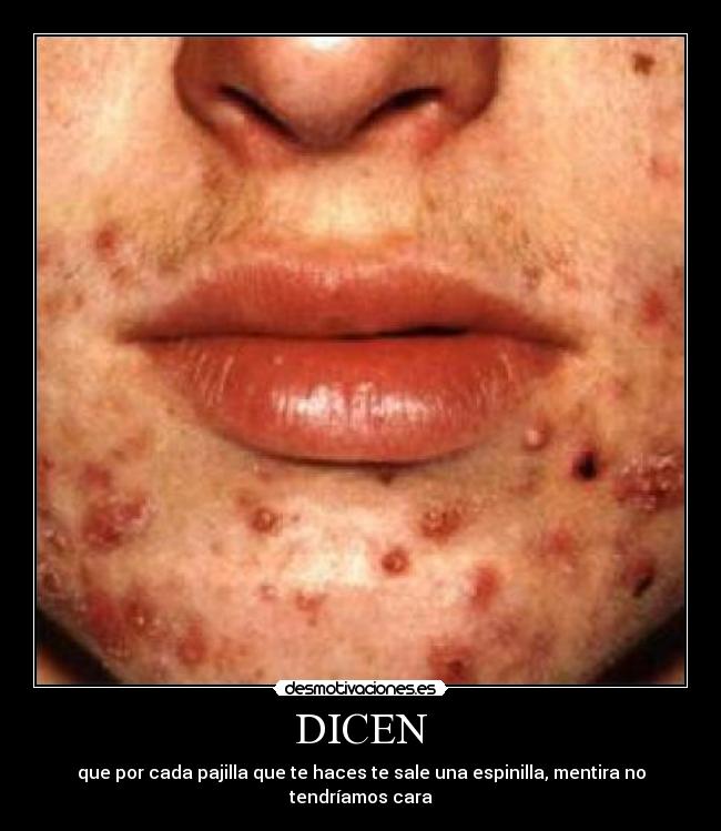 DICEN - que por cada pajilla que te haces te sale una espinilla, mentira no tendríamos cara