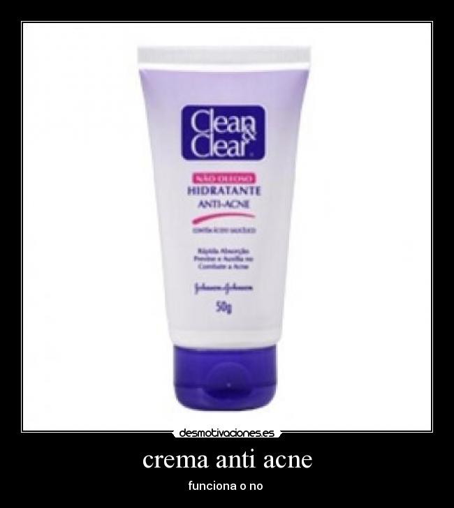 crema anti acne - funciona o no 