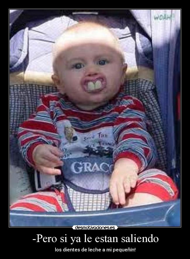 -Pero si ya le estan saliendo - los dientes de leche a mi pequeñín!