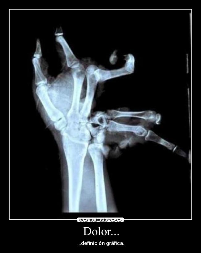 carteles dolor dolor definicion grafica desmotivaciones
