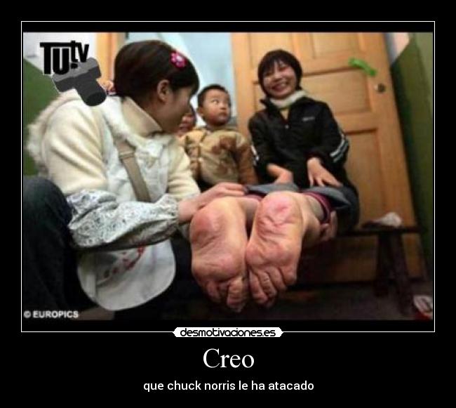 Creo - que chuck norris le ha atacado