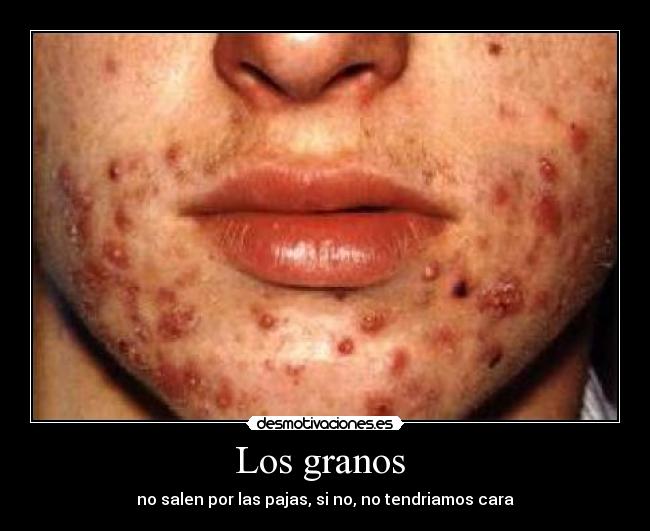 Los granos  - 