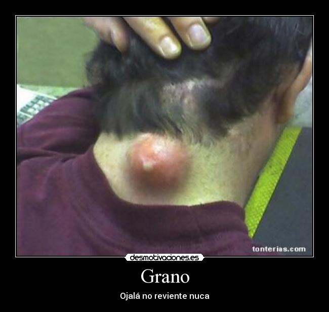 Grano - 