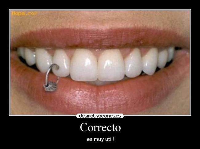 Correcto - es muy util!