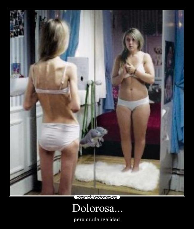 Dolorosa... - pero cruda realidad.
