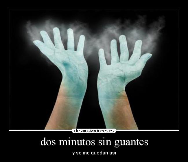 dos minutos sin guantes - y se me quedan asi
