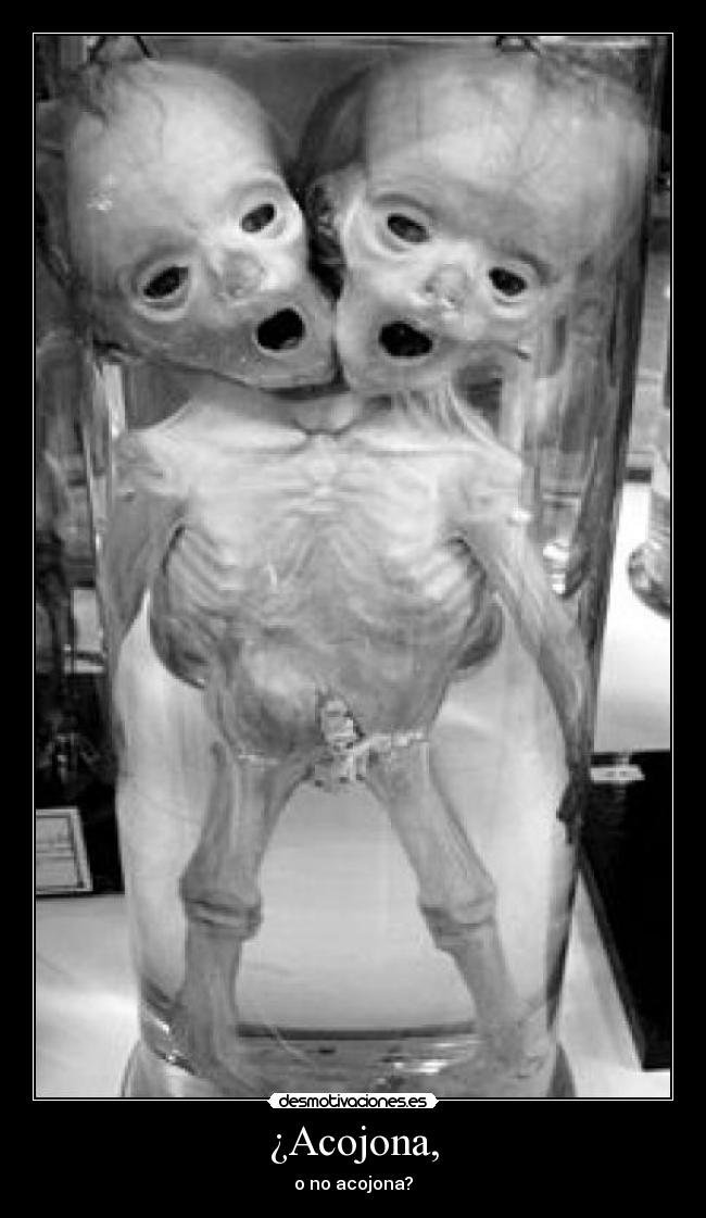 ¿Acojona, - 