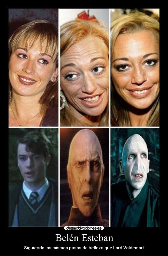 Belén Esteban -