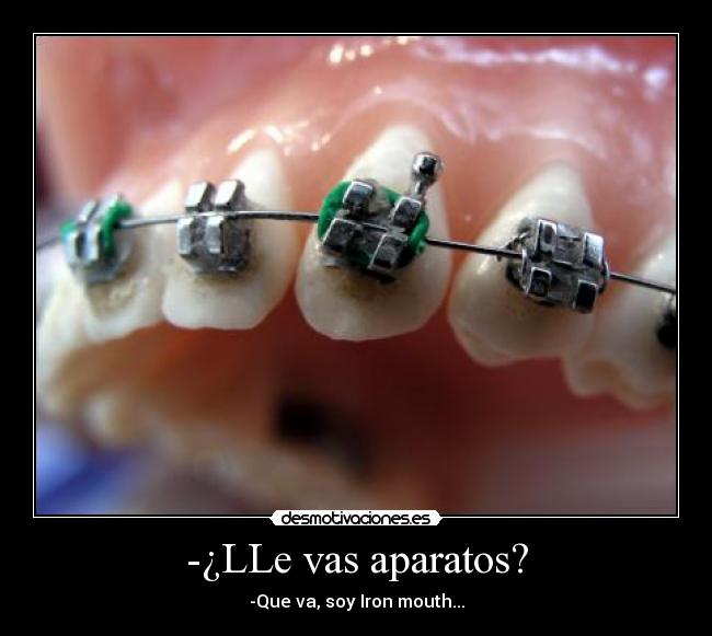 -¿LLe vas aparatos? - -Que va, soy Iron mouth...