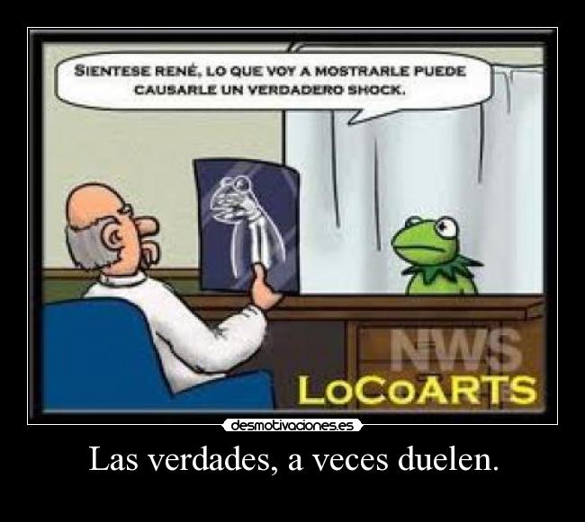 Las verdades, a veces duelen. -