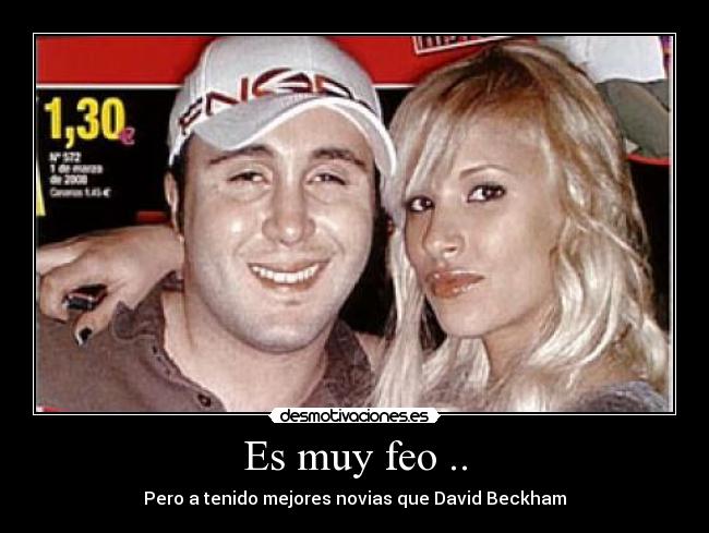 Es muy feo .. - Pero a tenido mejores novias que David Beckham