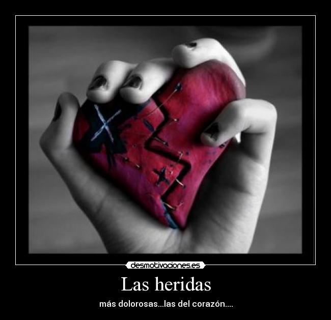 Las heridas - más dolorosas...las del corazón....