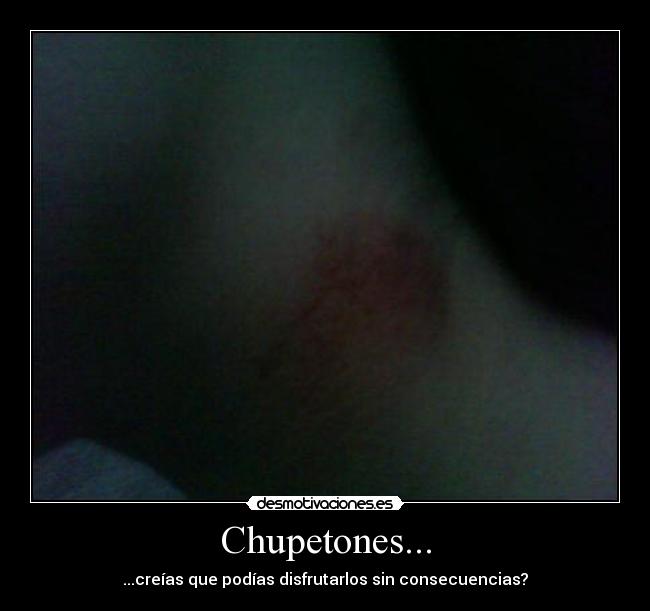 Chupetones... -