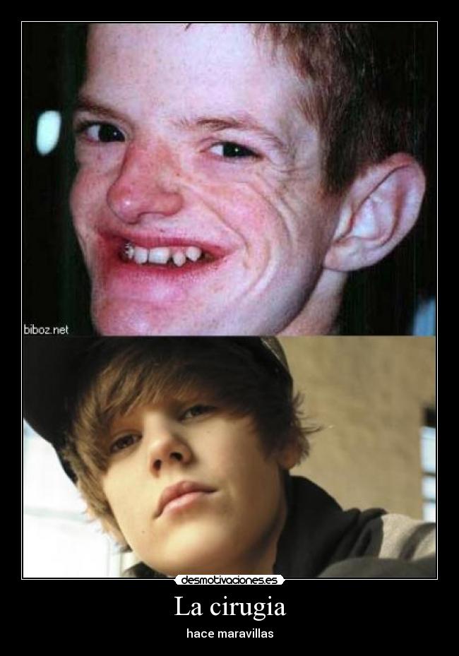 La cirugia - hace maravillas