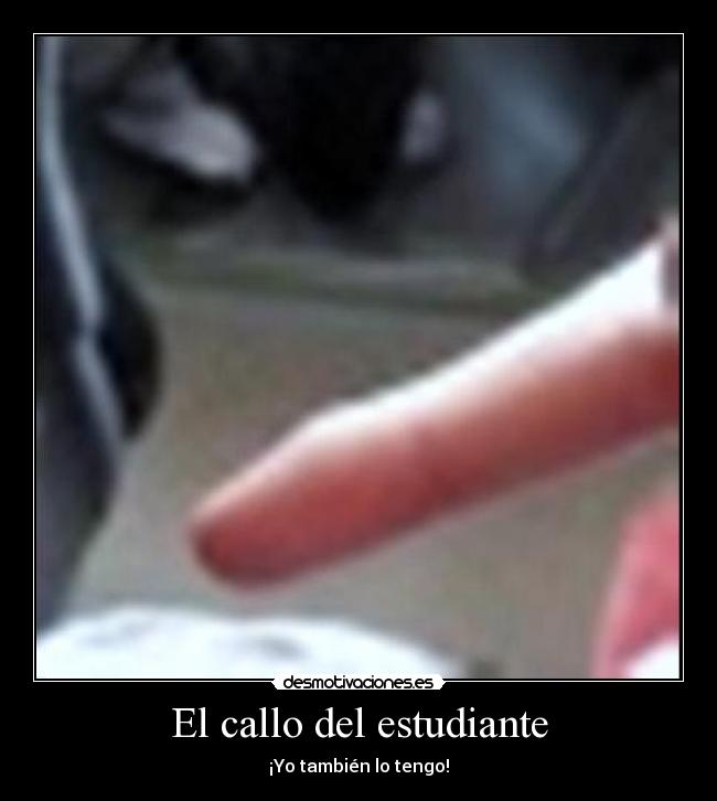 El callo del estudiante -