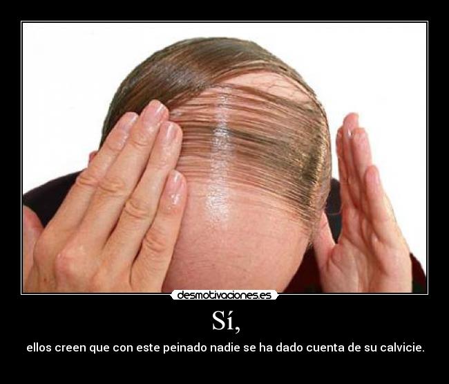 Sí, - ellos creen que con este peinado nadie se ha dado cuenta de su calvicie.
