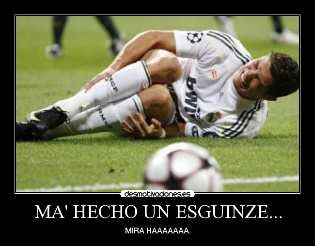 MA HECHO UN ESGUINZE... -