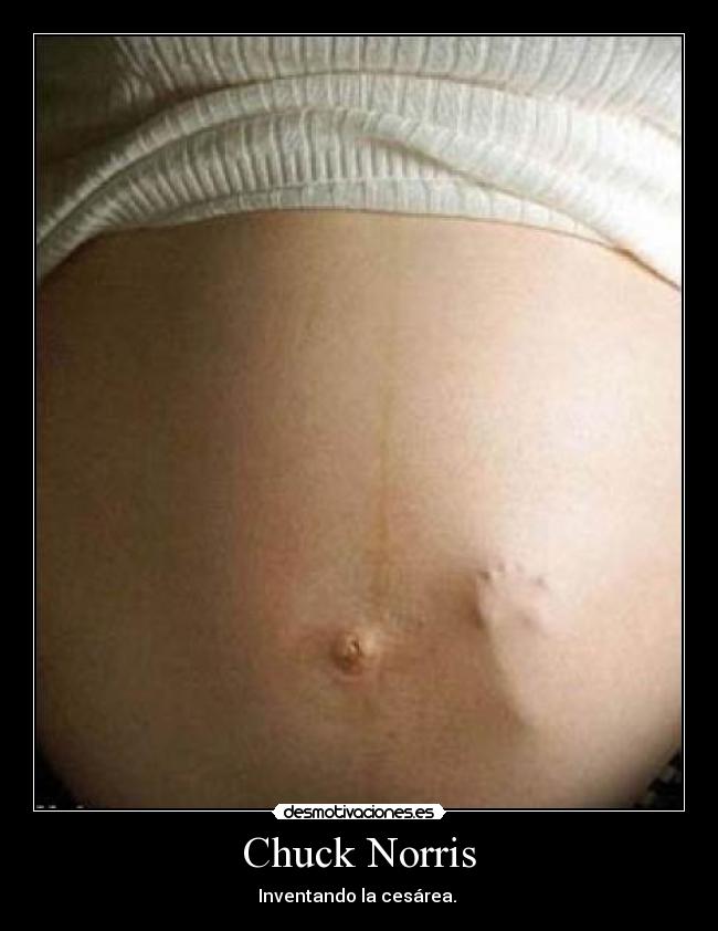 carteles alaude desmotivaciones