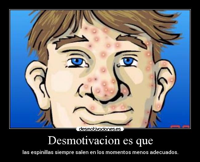 Desmotivacion es que -