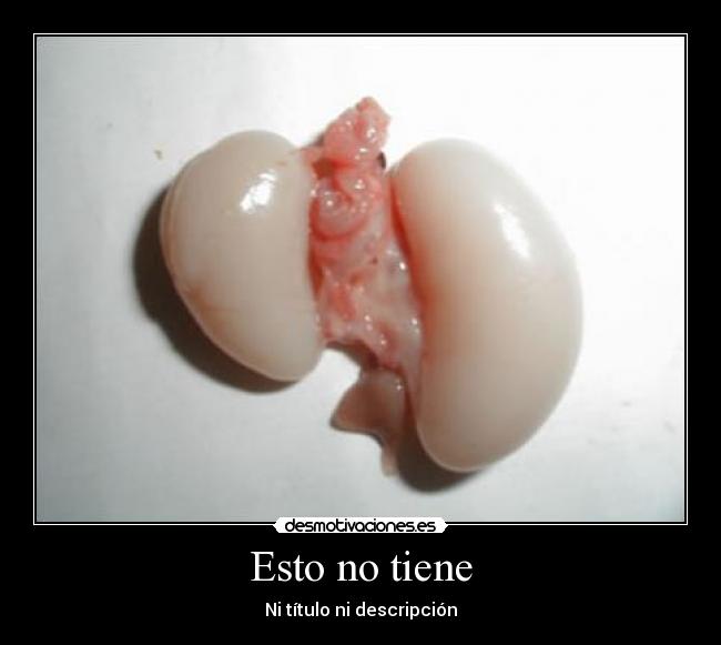 Esto no tiene - Ni título ni descripción