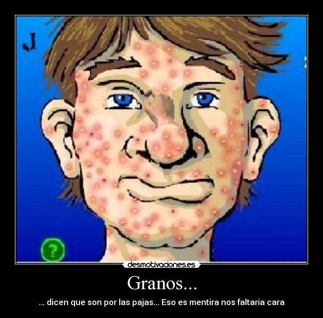 Granos... - 