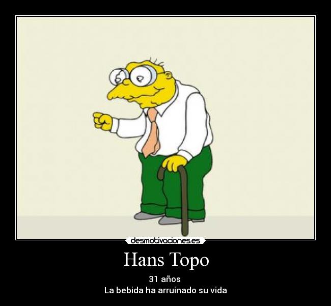 Hans Topo - 