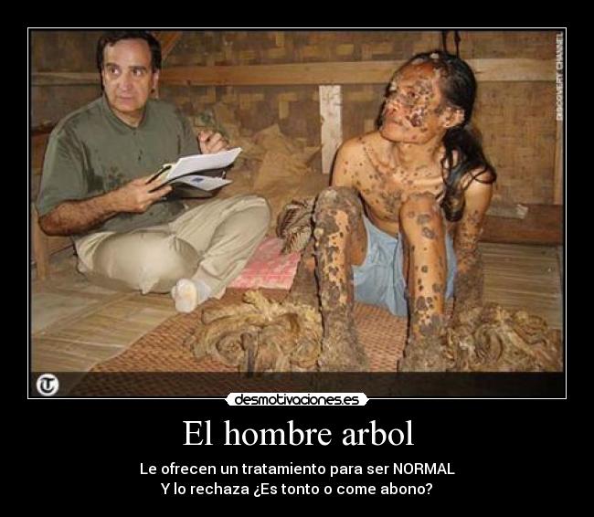 El hombre arbol -