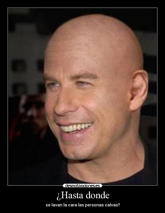 ¿Hasta donde - se lavan la cara las personas calvas?
