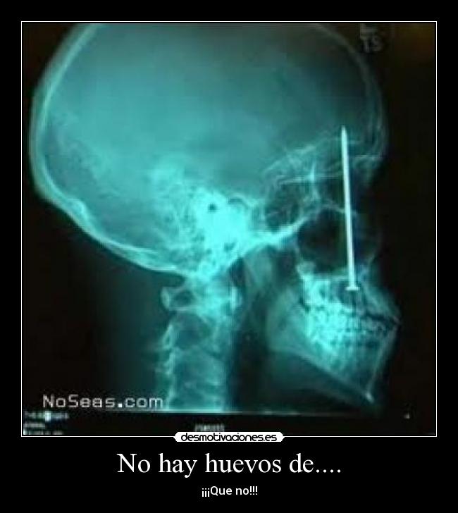 No hay huevos de.... - ¡¡¡Que no!!!