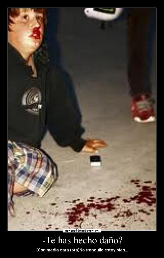 -Te has hecho daño? - (Con media cara rota)No tranquilo estoy bien...