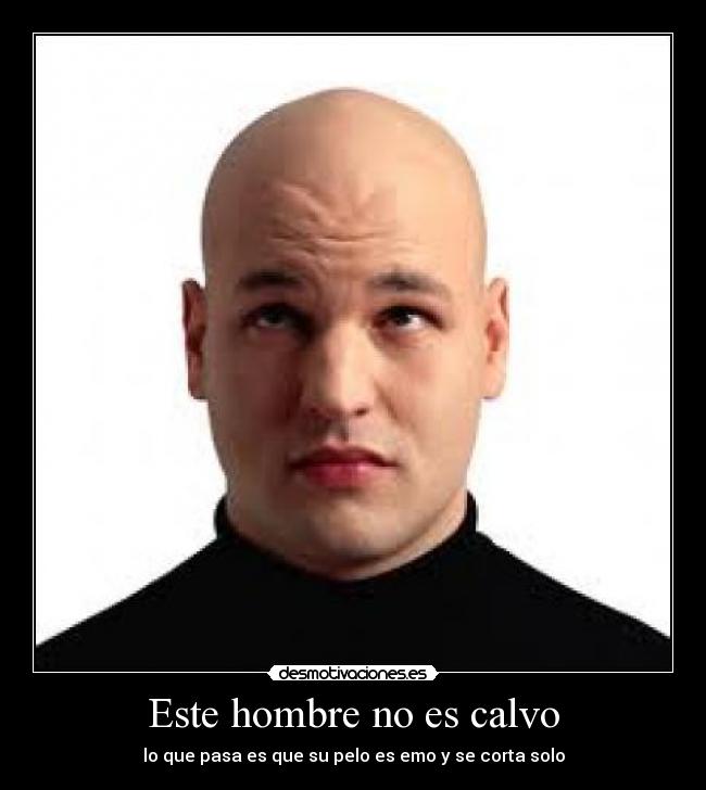 Este hombre no es calvo - 