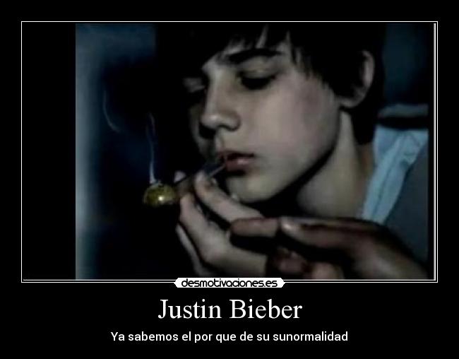 Justin Bieber - Ya sabemos el por que de su sunormalidad
