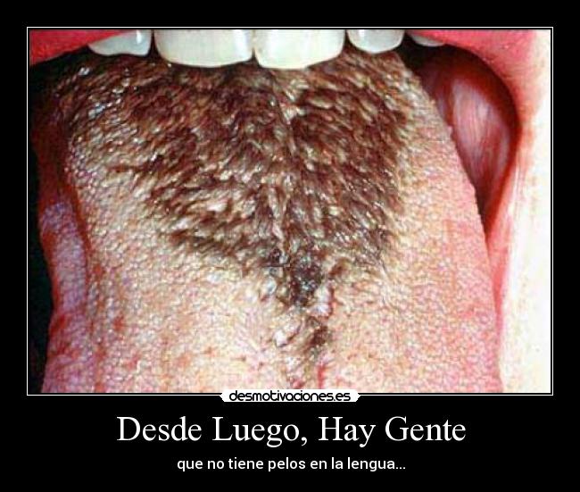 Desde Luego, Hay Gente - 