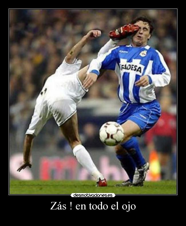 Zás ! en todo el ojo -