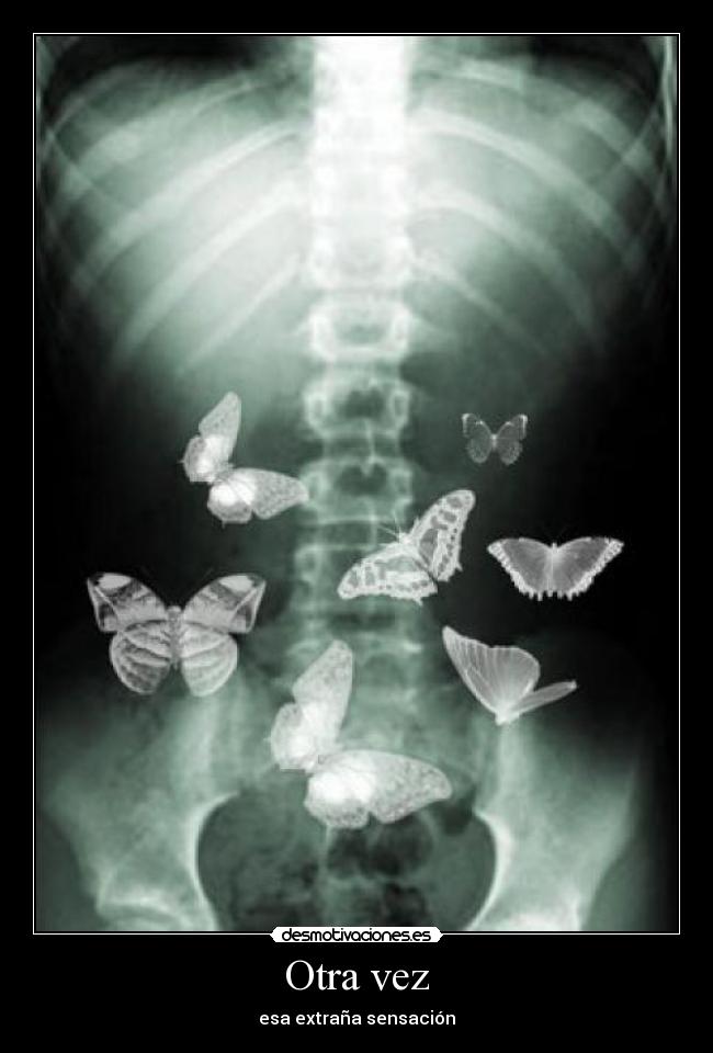 Otra vez - esa extraña sensación