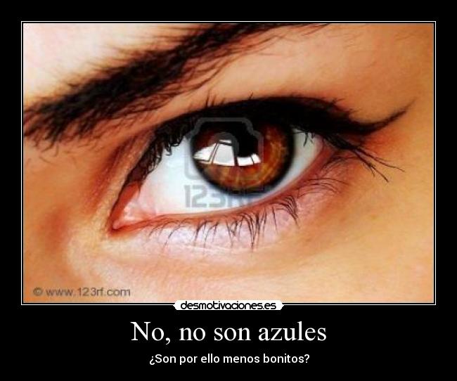 No, no son azules -