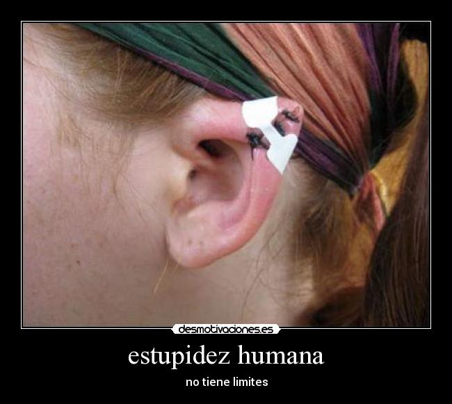 estupidez humana - no tiene limites