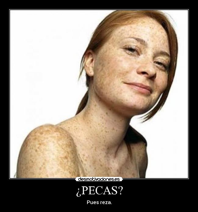 ¿PECAS? - Pues reza.